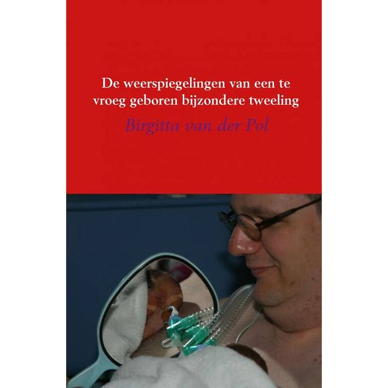 Foto van De weerspiegelingen van een te vroeg geboren bijzondere tweeling