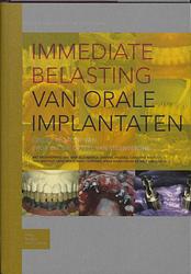 Foto van Immediate belasting van orale implantaten - paperback (9789031351749)