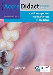 Foto van Aandoeningen van mondslijmvlies en tandvlees - isaäc van der waal - paperback (9789089763884)