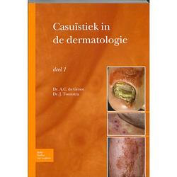 Foto van Casuïstiek in de dermatologie / deel 1