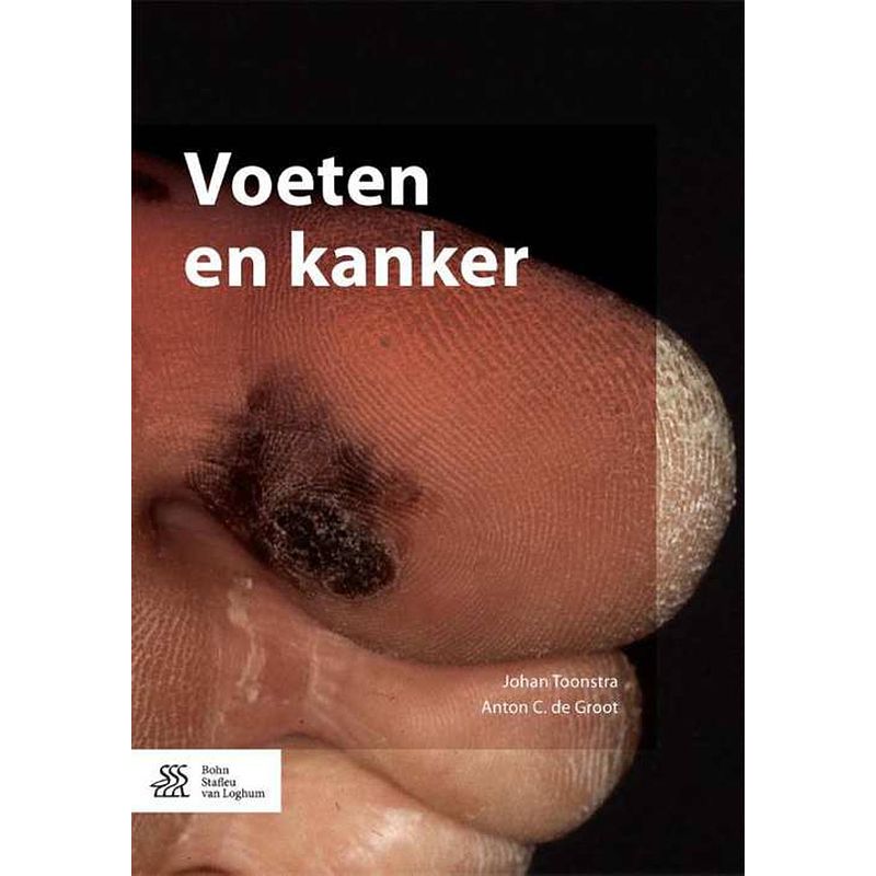 Foto van Voeten en kanker