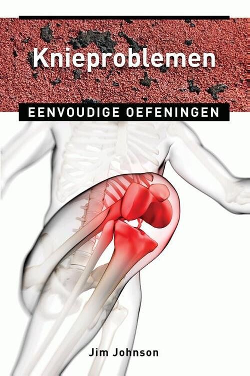 Foto van Knieproblemen - jim johnson - ebook (9789020209709)