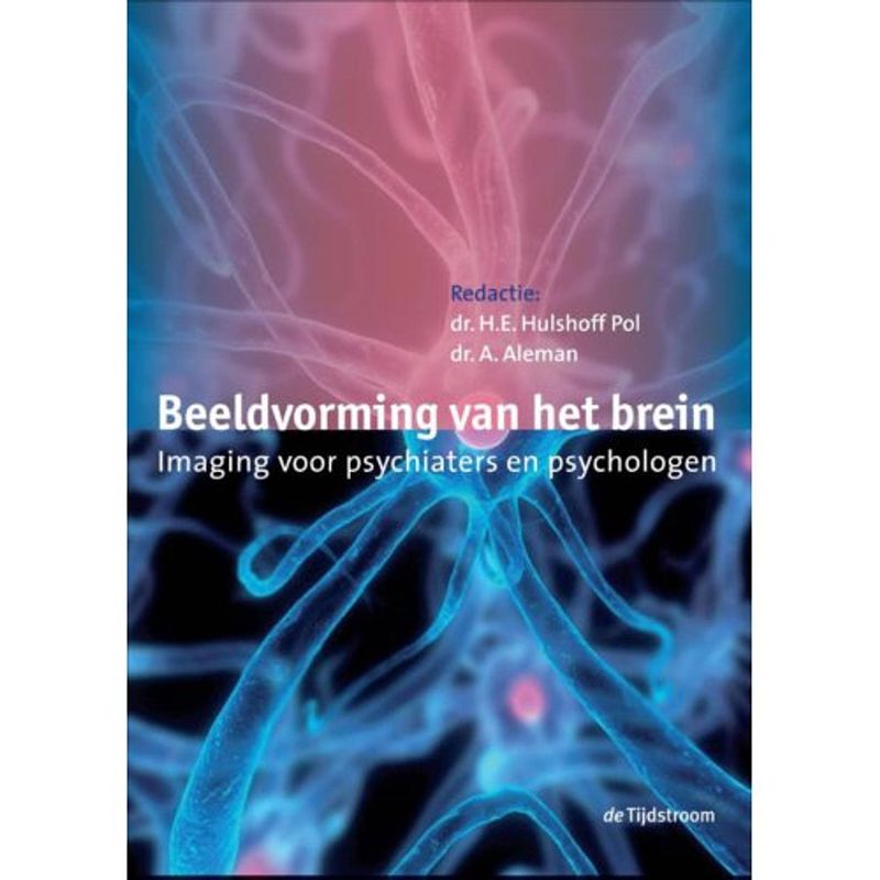 Foto van Beeldvorming van het brein