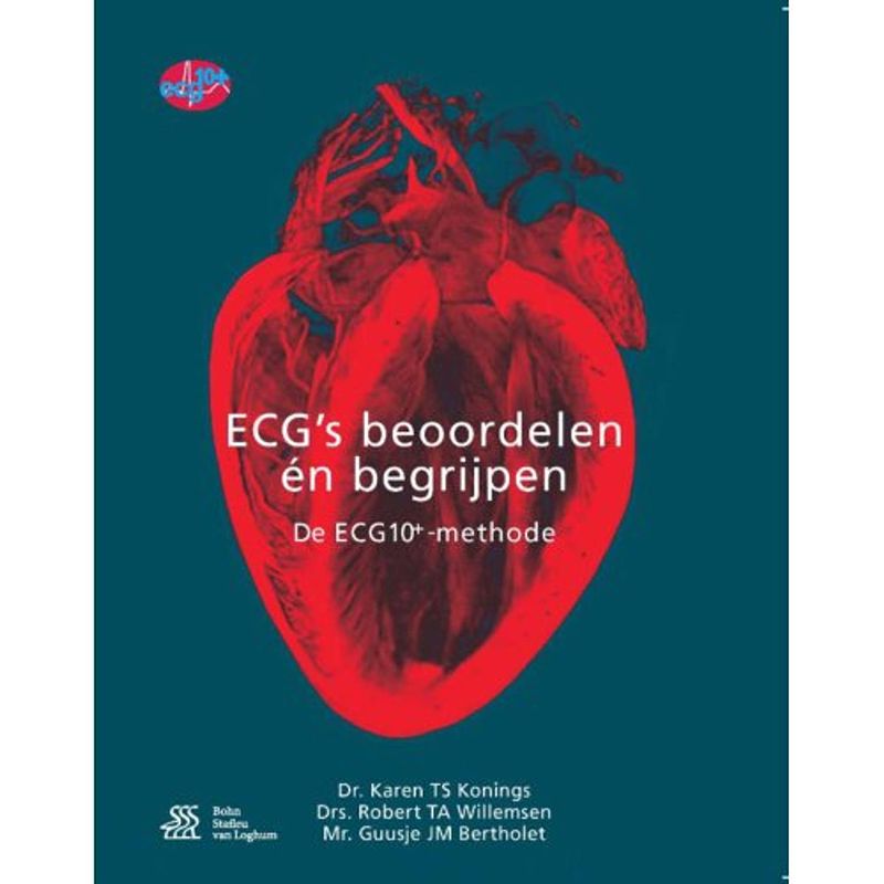 Foto van Ecg's - beoordelen