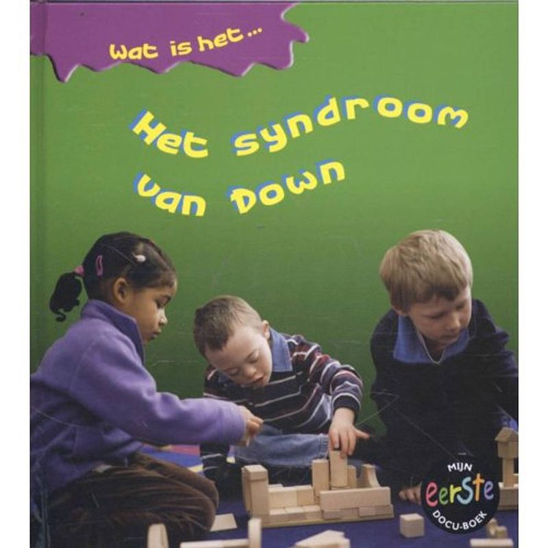 Foto van Het syndroom van down - wat is het...