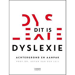 Foto van Dit is dyslexie