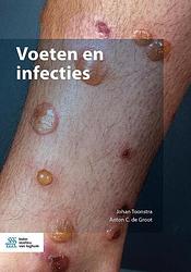 Foto van Voeten en infecties - anton de groot, johan toonstra - paperback (9789036829168)
