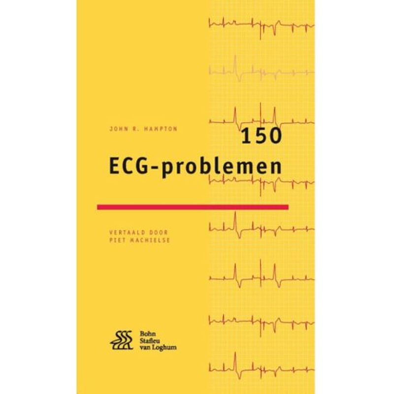 Foto van 150 ecg-problemen