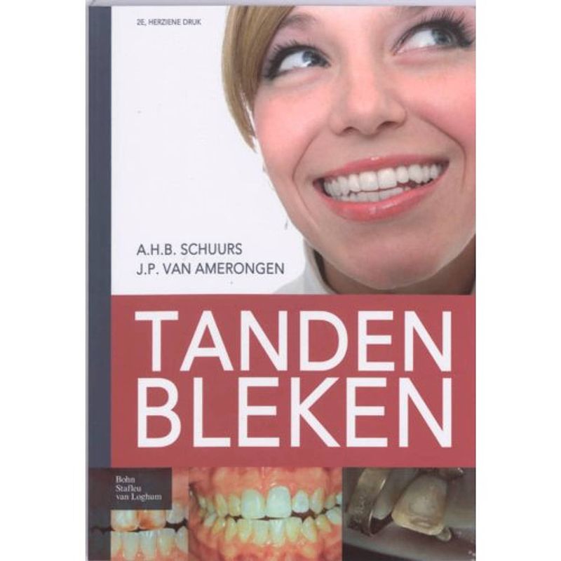 Foto van Tanden bleken