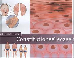 Foto van Zorgatlas constitutioneel eczeem - rob beljaards - hardcover (9789491984433)