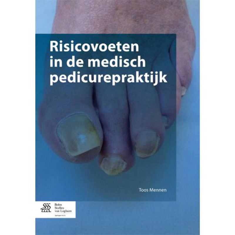 Foto van Risicovoeten in de medisch pedicureprakt