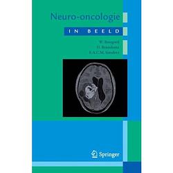 Foto van Neuro-oncologie in beeld