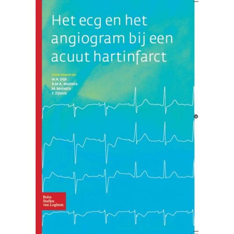 Foto van Het ecg en het angiogram bij een acuut hartinfarct