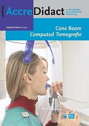 Foto van Cone beam computed tomografie - paul van der stelt - paperback (9789089763501)