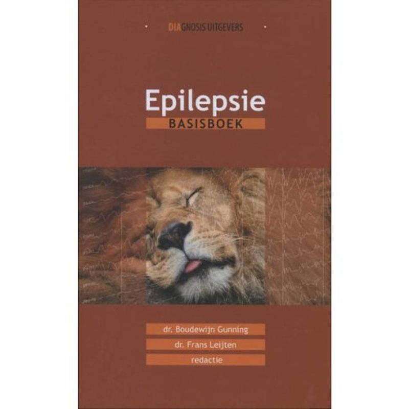 Foto van Epilepsie