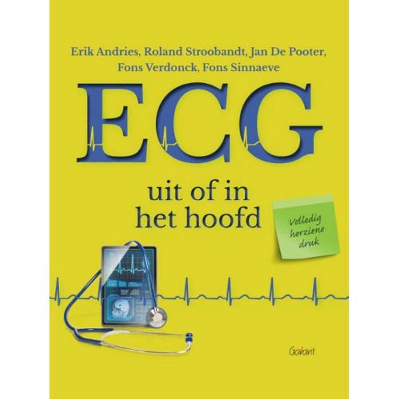 Foto van Ecg