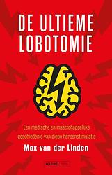 Foto van De ultieme lobotomie - max van der linden - ebook