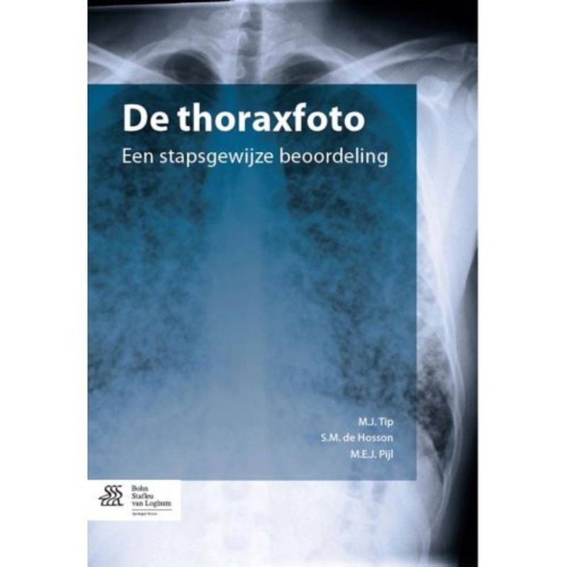 Foto van De thoraxfoto