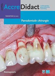Foto van Parodontale chirurgie - alexander verhelst - paperback (9789089764577)