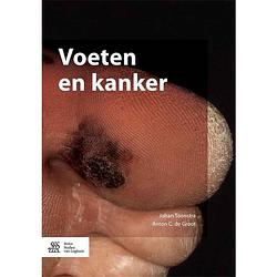 Foto van Voeten en kanker