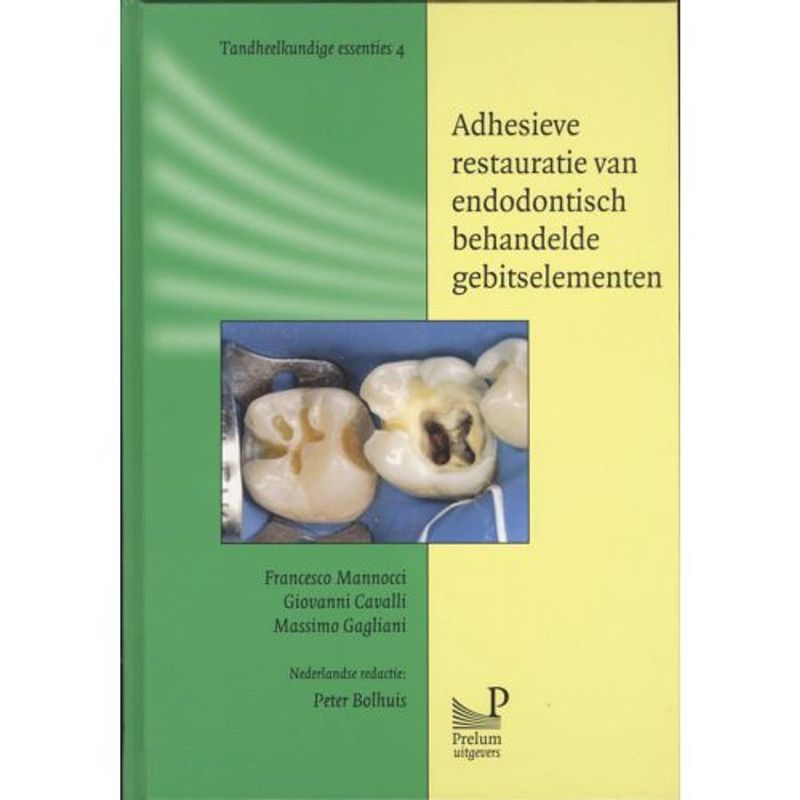 Foto van Adhesieve restauratie van endodontisch behandelde