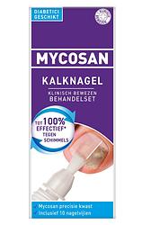 Foto van Mycosan behandelset kalknagel