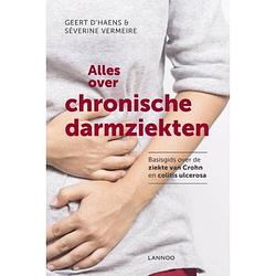 Foto van Alles over chronische darmziekten