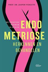 Foto van Endometriose herkennen en behandelen - prof. dr. jasper verguts - paperback (9789022338971)