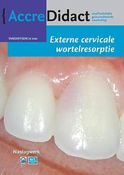 Foto van Externe cervicale wortelresorptie - athina mavridou - paperback (9789089763754)