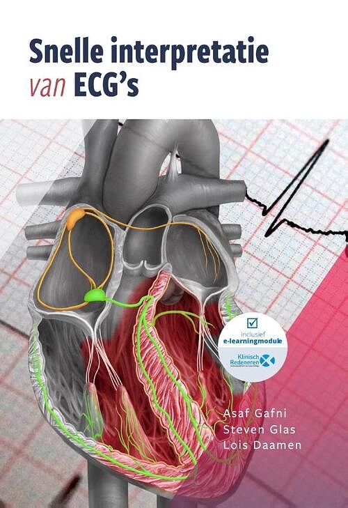 Foto van Snelle interpretatie van ecg's - asaf gafni, lois a. daamen, steven c. glas - paperback (9789083139319)