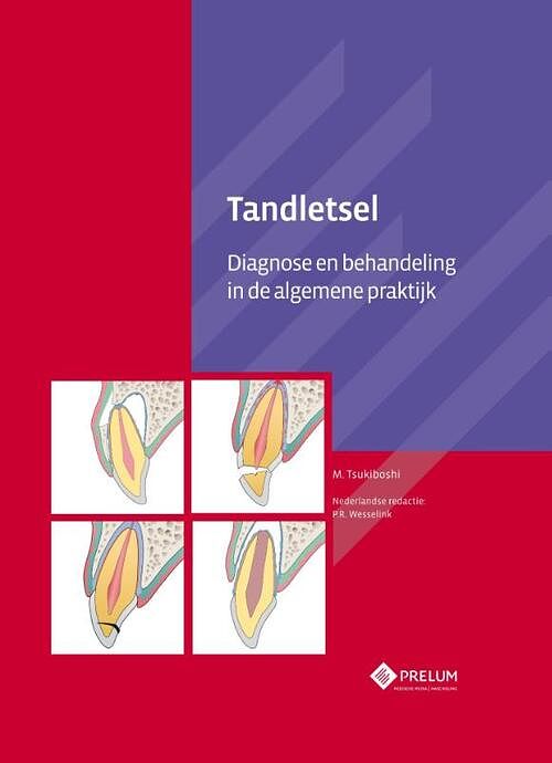 Foto van Tandletsel - m. tsukiboshi - hardcover (9789085621294)