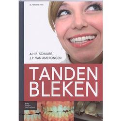 Foto van Tanden bleken