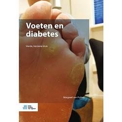 Foto van Voeten en diabetes