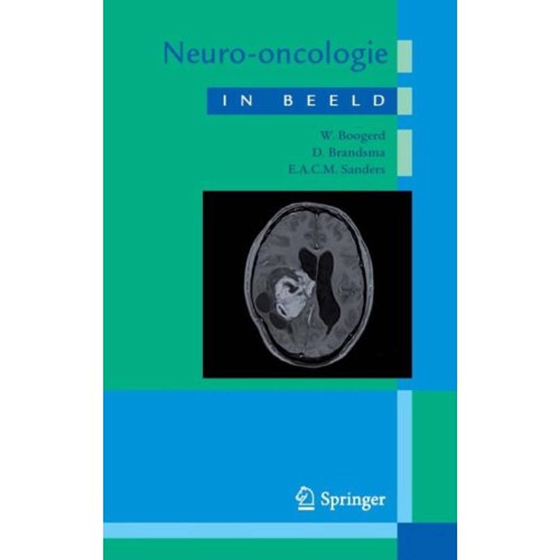 Foto van Neuro-oncologie in beeld