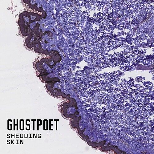 Foto van Shedding skin - lp (5414939917240)