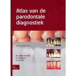 Foto van Atlas van de parodontale diagnostiek