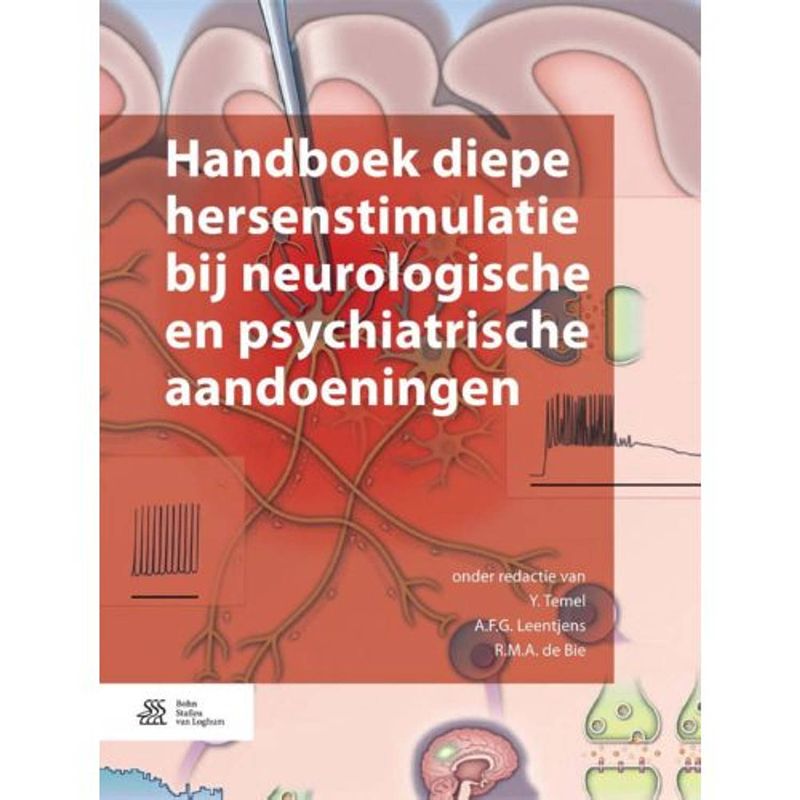 Foto van Handboek diepe hersenstimulatie bij neur