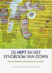 Foto van De nipt en het syndroom van down - hans kröber, xavier moonen - paperback (9789492261939)