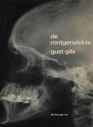 Foto van De röntgenziekte - gust gils - ebook (9789023474319)