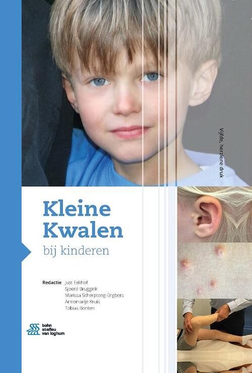 Foto van Kleine kwalen bij kinderen - paperback (9789036827386)