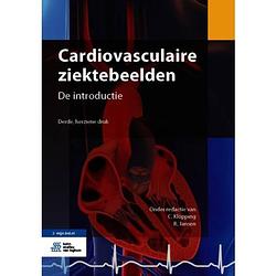 Foto van Cardiovasculaire ziektebeelden - kernboek