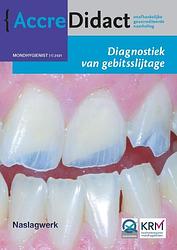 Foto van Diagnostiek van gebitsslijtage - frank lobbezoo, peter wetselaar - paperback (9789089763785)