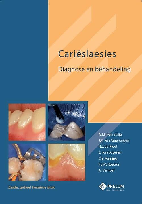 Foto van Carieslaesies - a.j.p. van strijp - hardcover (9789085621300)