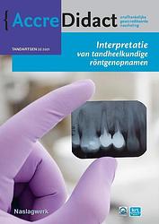 Foto van Interpretatie van tandheelkundige röntgenopnamen - kostas syriopoulos, paul van der stelt - paperback (9789089764065)