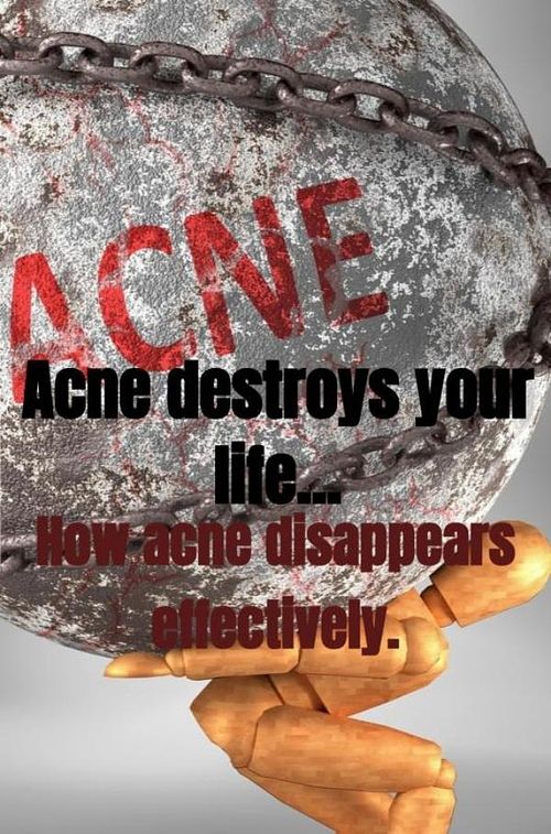 Foto van Acne destroys your life... - jaquelien papenhuijzen - ebook