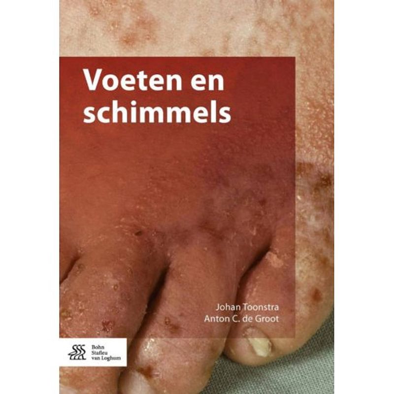 Foto van Voeten en schimmels