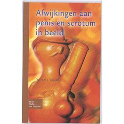 Foto van Afwijkingen aan penis en scrotum in beeld