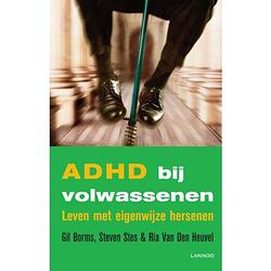 Foto van Adhd bij volwassenen