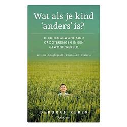 Foto van Wat als je kind 'sanders's is?