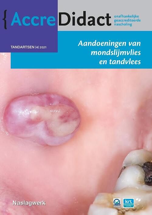 Foto van Aandoeningen van mondslijmvlies en tandvlees - isaäc van der waal - paperback (9789089764096)